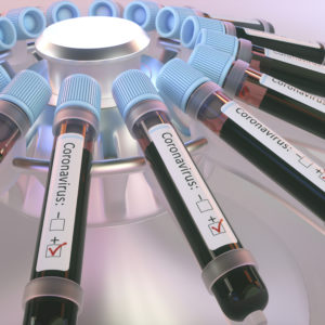 Coronaviruses research, conceptual illustration. Vials of blood in a centrifuge being tested for coronavirus infection.