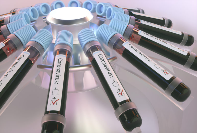 Coronaviruses research, conceptual illustration. Vials of blood in a centrifuge being tested for coronavirus infection.